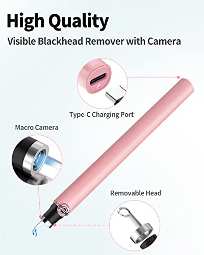 Blackhead Remover